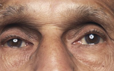 O bacterie din retină, legată de boala Alzheimer și declinul cognitiv Prezența bacteriei Chlamydia pneumoniae în retină ar putea fi un indicator al declinului cognitiv și al bolii Alzheimer, potrivit unui studiu recent realizat de cercetătorii de la Cedars-Sinai Medical Center din Statele Unite