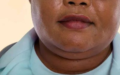 Exercițiul zilnic, acasă, care reduce bărbia dublă