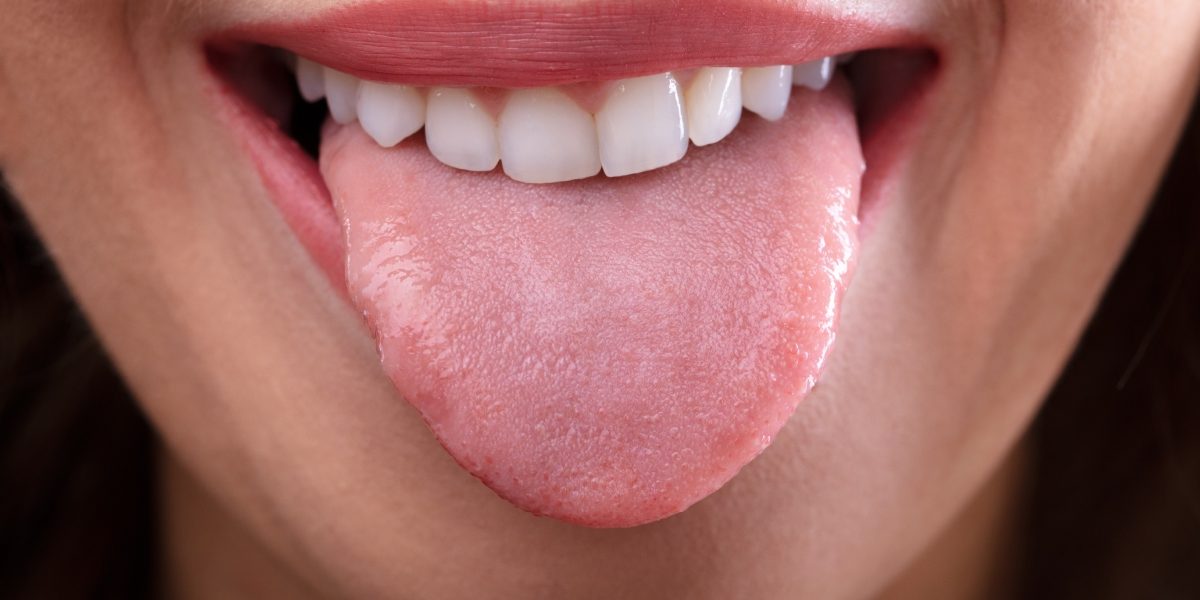 Culoarea limbii, indiciu esențial pentru starea de sănătate