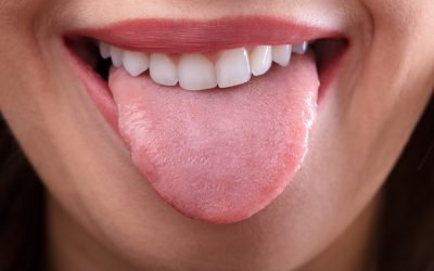 Culoarea limbii, indiciu esențial pentru starea de sănătate