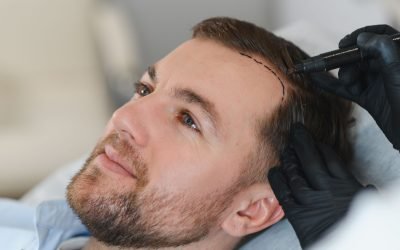 O descoperire promițătoare: Foliculi de păr umani, crescuți cu succes în laborator O echipă de cercetători din Statele Unite și Japonia a făcut un pas important în domeniul regenerării părului, reușind să creeze foliculi de păr complet funcționali în laborator