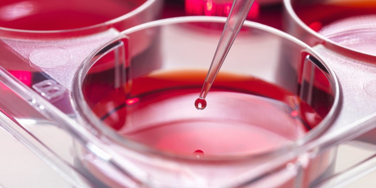 Oamenii de știință descoperă o metodă de blocare a leucemiei agresive