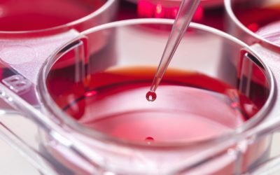 Oamenii de știință descoperă o metodă de blocare a leucemiei agresive