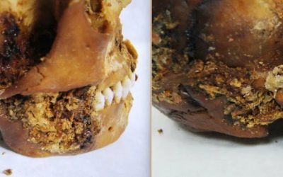 O femeie scită mumificată, operată la maxilar acum 2500 de ani: o descoperire uluitoare în Siberia Arheologii au făcut o descoperire remarcabilă în Siberia: o femeie scită, mumificată, a supraviețuit unei intervenții chirurgicale complexe la maxilar, acum aproximativ 2500 de ani