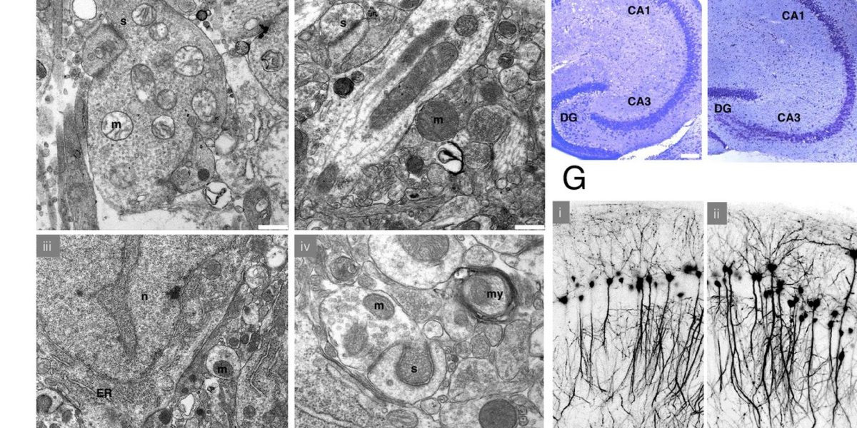 Noi experimente: Creierul crioconservat, readus la viață?