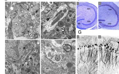 Noi experimente: Creierul crioconservat, readus la viață?
