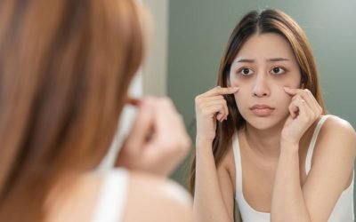 Pielea palidă: Posibile semnale despre starea de sănătate