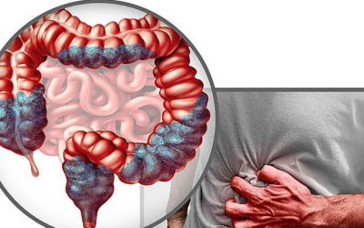 Cancerul colorectal, o boală tot mai frecventă la tineri: un studiu arată modificări în structura colonului Medicii avertizează asupra importanței unei diete echilibrate pentru prevenirea deficiențelor nutriționale și a riscului de cancer colorectal
