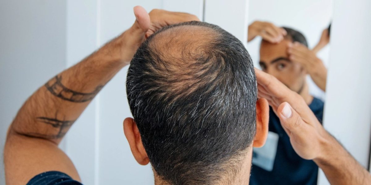 O nouă speranță pentru cei afectați de căderea părului: cercetătorii au reușit să creeze foliculi de păr funcționali în laborator Un nou studiu științific aduce o veste promițătoare pentru persoanele care suferă de căderea părului