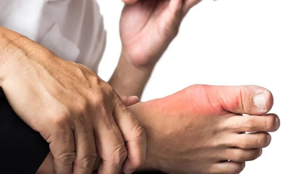 Alimente care pot provoca gută: Românii le consumă zilnic