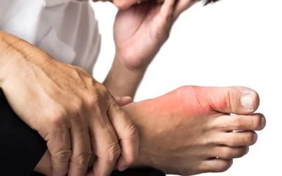 Alimente care pot provoca gută: Românii le consumă zilnic