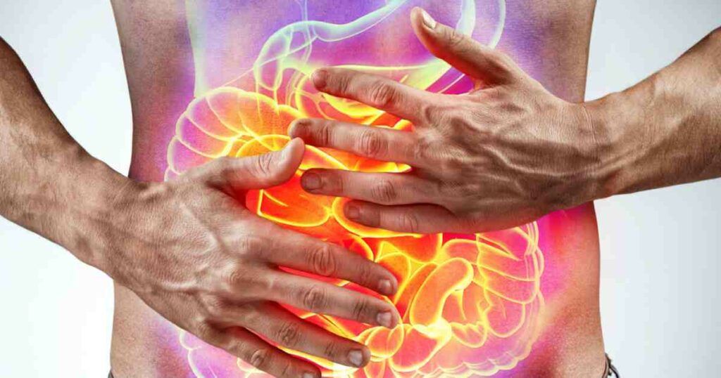 Alimente care irită intestinul și pot declanșa sindromul colonului iritabil