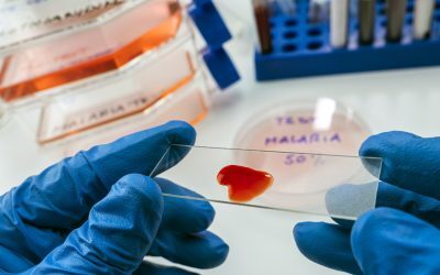 Alertă de malarie în Iași: Trei copii, recent întorși din Africa, au fost diagnosticați Ministerul Sănătății a raportat confirmarea a trei cazuri suspecte de malarie la minori, în urma evaluărilor efectuate într-o unitate medicală din Iași, în data de 23 martie