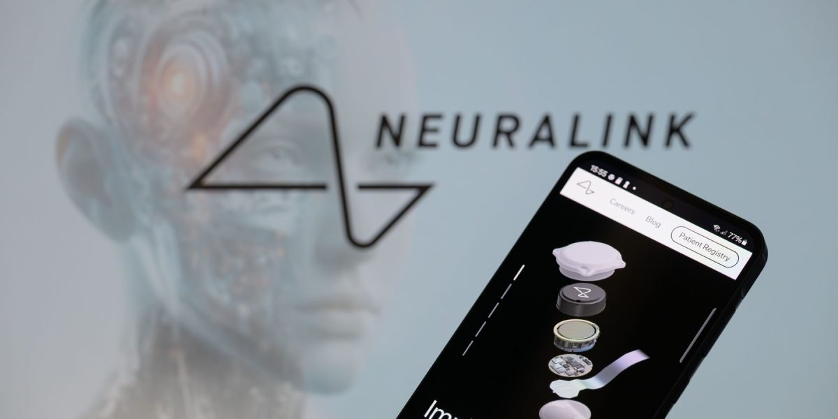 China aprobă primul implant cerebral comercial, o lovitură pentru startup-urile locale Shanghai, China – Autoritățile chineze au aprobat comercializarea unui implant cerebral dezvoltat de compania Neuracle Technology din Shanghai, o premieră pentru piața locală de dispozitive medicale