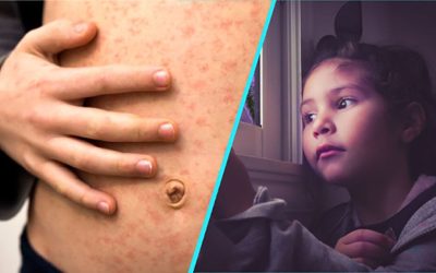 Alertă pe un zbor internațional: Rujeolă la bord, pasagerii expuși sunt căutați de autorități