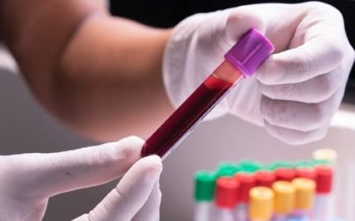 Poluarea cu dioxid de carbon afectează sănătatea umană: Studiu alarmant Un studiu recent, realizat de cercetători australieni, a relevat o creștere îngrijorătoare a nivelului de dioxid de carbon (CO2) în sângele uman