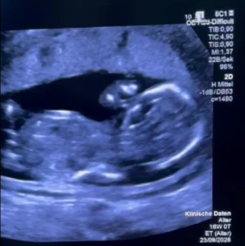 Gravidă, umilită la Filantropia București, obligată la tratament în Germania