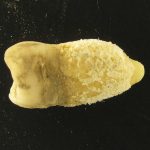 Bacterie de scarlatină, găsită într-o mumie! Descoperirea uimitoare