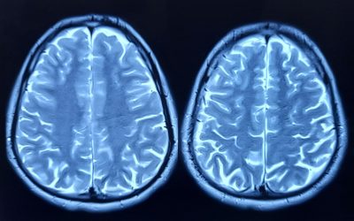 Oamenii de știință au găsit secretul îmbătrânirii creierului