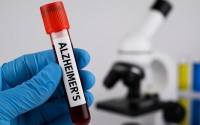 Un test de sânge simplu ar putea identifica riscul de demență cu zeci de ani înainte de apariția primelor simptome, deschizând calea pentru măsuri de prevenție și tratament mai eficiente