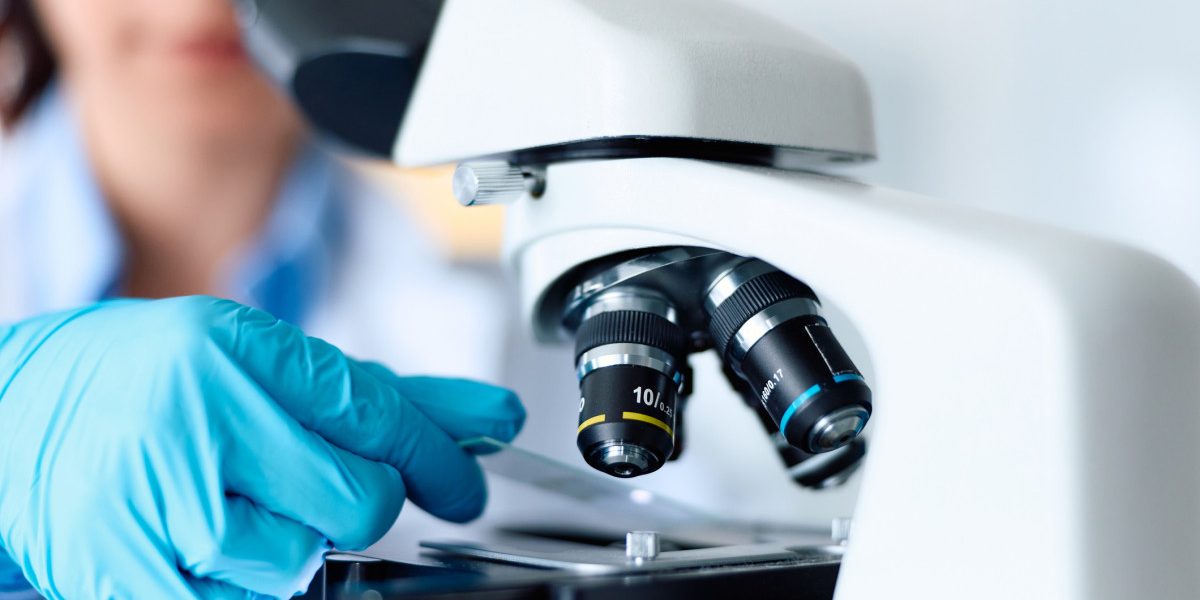 Celule nervoase: Secretul care ar putea vindeca Parkinson