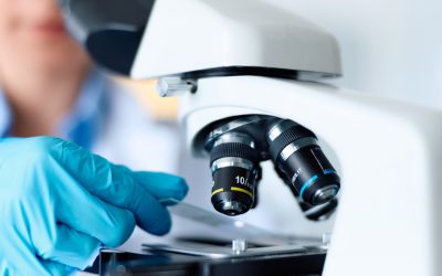 Celule nervoase: Secretul care ar putea vindeca Parkinson