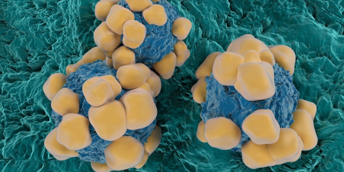 Oamenii de știință au dezvoltat senzori microscopici, de grosimea unui fir de păr, capabili să detecteze simultan mai mulți biomarkeri ai cancerului