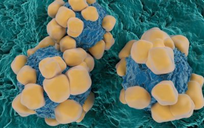 Oamenii de știință au dezvoltat senzori microscopici, de grosimea unui fir de păr, capabili să detecteze simultan mai mulți biomarkeri ai cancerului