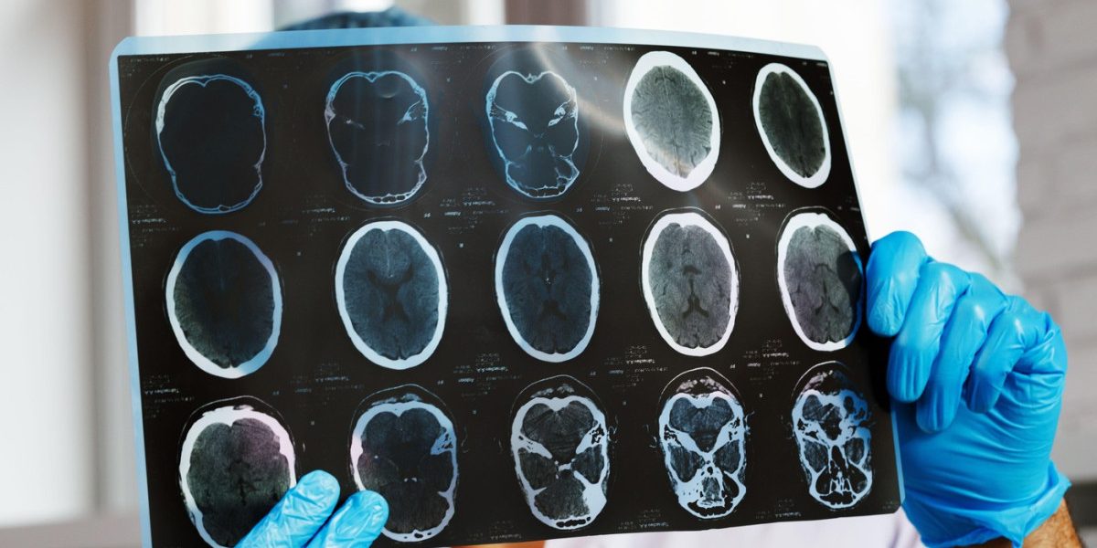 Asociațiile de pacienți, revoltate: Investigațiile medicale, prăbușite cu 47%