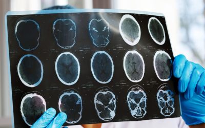 Asociațiile de pacienți, revoltate: Investigațiile medicale, prăbușite cu 47%