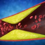 7 semne ignorate: Cardiologii avertizează asupra arterelor blocate, riscuri majore!