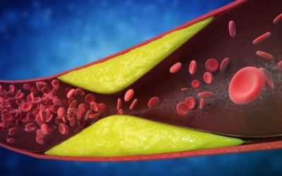 7 semne ignorate: Cardiologii avertizează asupra arterelor blocate, riscuri majore!