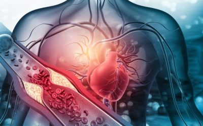 Artera curată și AVC prevenit: Alimentul-minune dezvăluit de un medic!