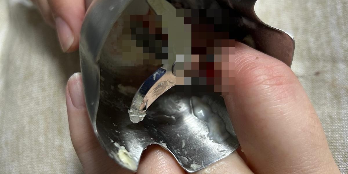 Două ieșence, victime ale unor accidente casnice grave