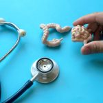 Tineri loviți de cancerul de colon: De ce crește alarmant, la nivel global?