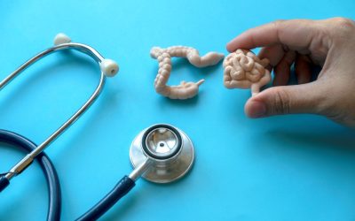 Tineri loviți de cancerul de colon: De ce crește alarmant, la nivel global?