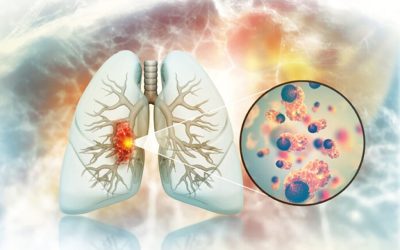 Crește alarmant cancerul pulmonar la nefumători. Medicii, în căutarea cauzelor