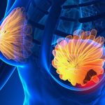 Semnele care te pot salva: 5 simptome ale cancerului de sân