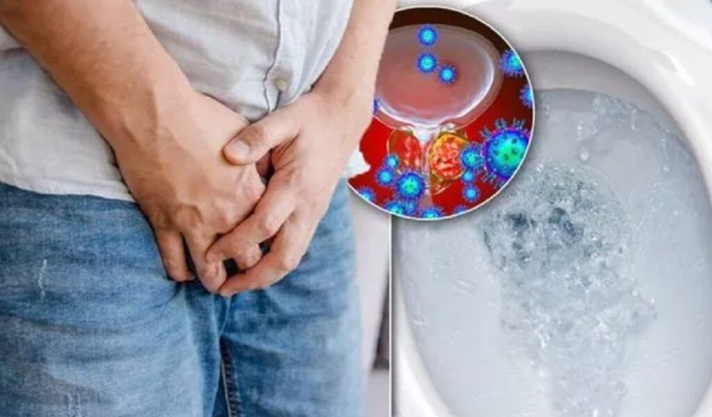 Cancerul „tăcut” amenință: 3 semne ignorate de bărbați, cu impact fatal