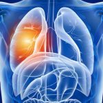 Plămânii, afectați după COVID-19: Studiu ȘOCANT despre efectele virusului