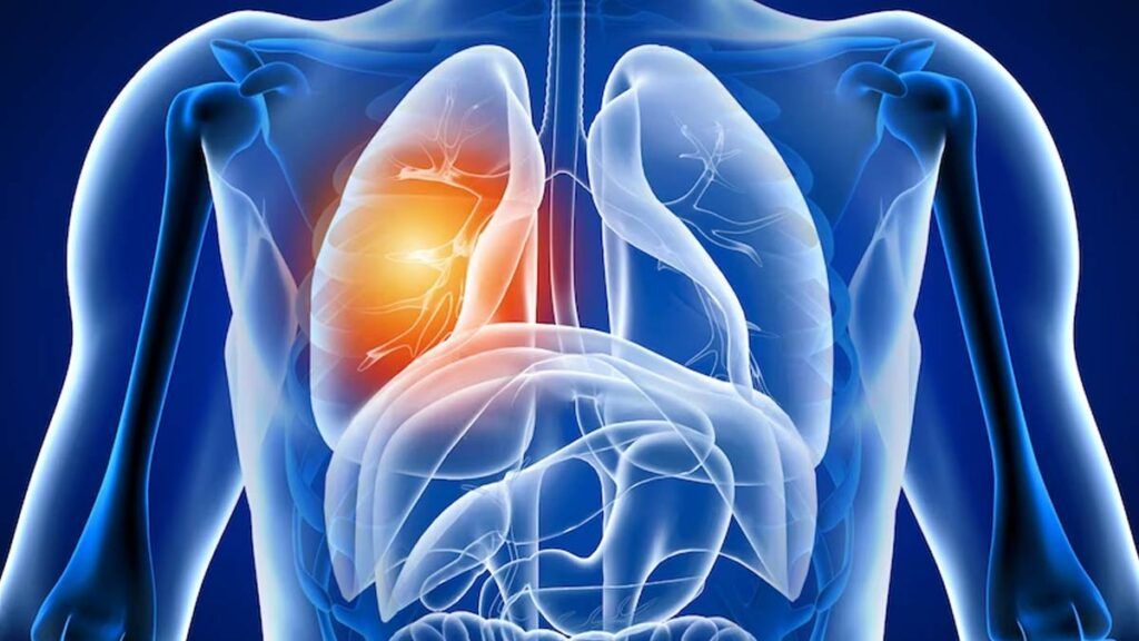 Plămânii, afectați după COVID-19: Studiu ȘOCANT despre efectele virusului