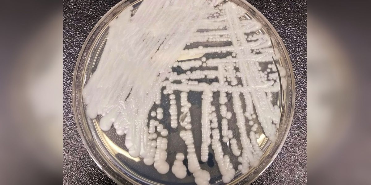 Candida auris, pericol în România: Cum o ținem sub control