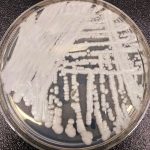 Candida auris, pericol în România: Cum o ținem sub control