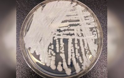 Candida auris, pericol în România: Cum o ținem sub control