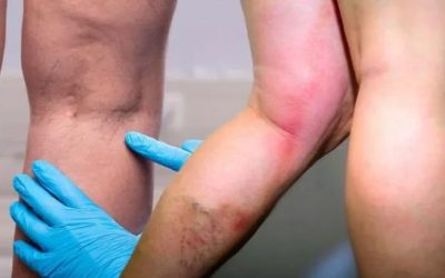 Vitamina-minune: Scut anti-cheaguri și imunitate de fier