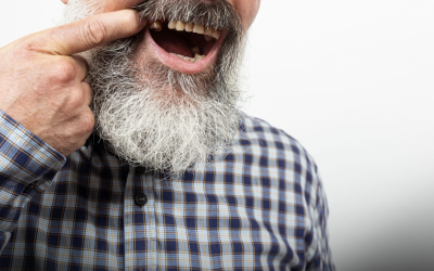 Pacienții cer dinți noi, Rapid, fără compromisuri. Ce soluții există?