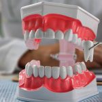 Extracție vs. Fără extracție în ortodonție: Ce aleg medicii și de ce