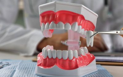 Extracție vs. Fără extracție în ortodonție: Ce aleg medicii și de ce