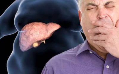 Boala ficatului gras, tratată fără dietă. Descoperirea cercetătorilor șochează lumea medicală