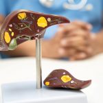 Boala SILENTIOASĂ ce lovește tinerii: Stilul de viață modern, un pericol ascuns